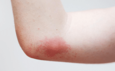 Nid de guêpes : quand contacter les pompiers ?