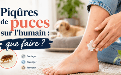Piqûres de puces sur l&rsquo;humain : que faire ?